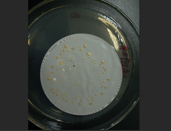 如何用计算机数培养皿的细菌数量?