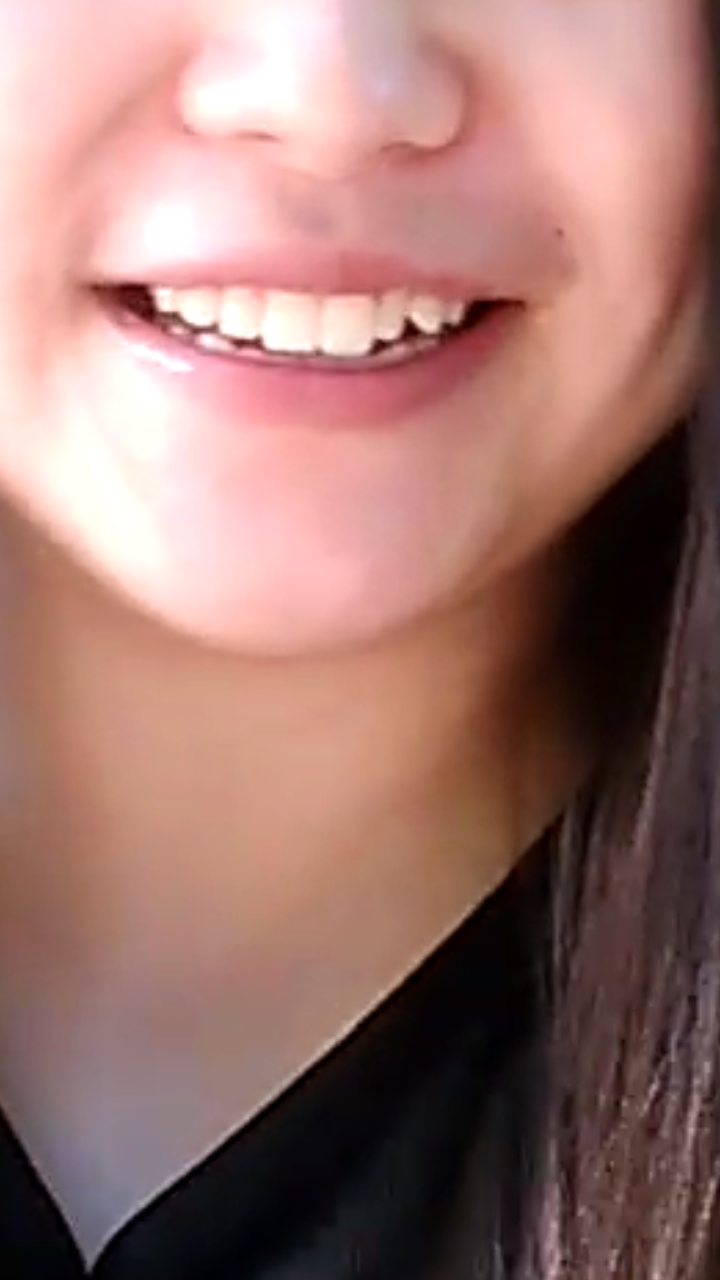 为什么我笑起来不好看?可以怎么纠正呢? - 外貌