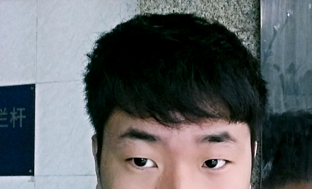 到夏天了<em>最近洗头</em>发现<em>头发</em>掉很多? - 郭亿的回