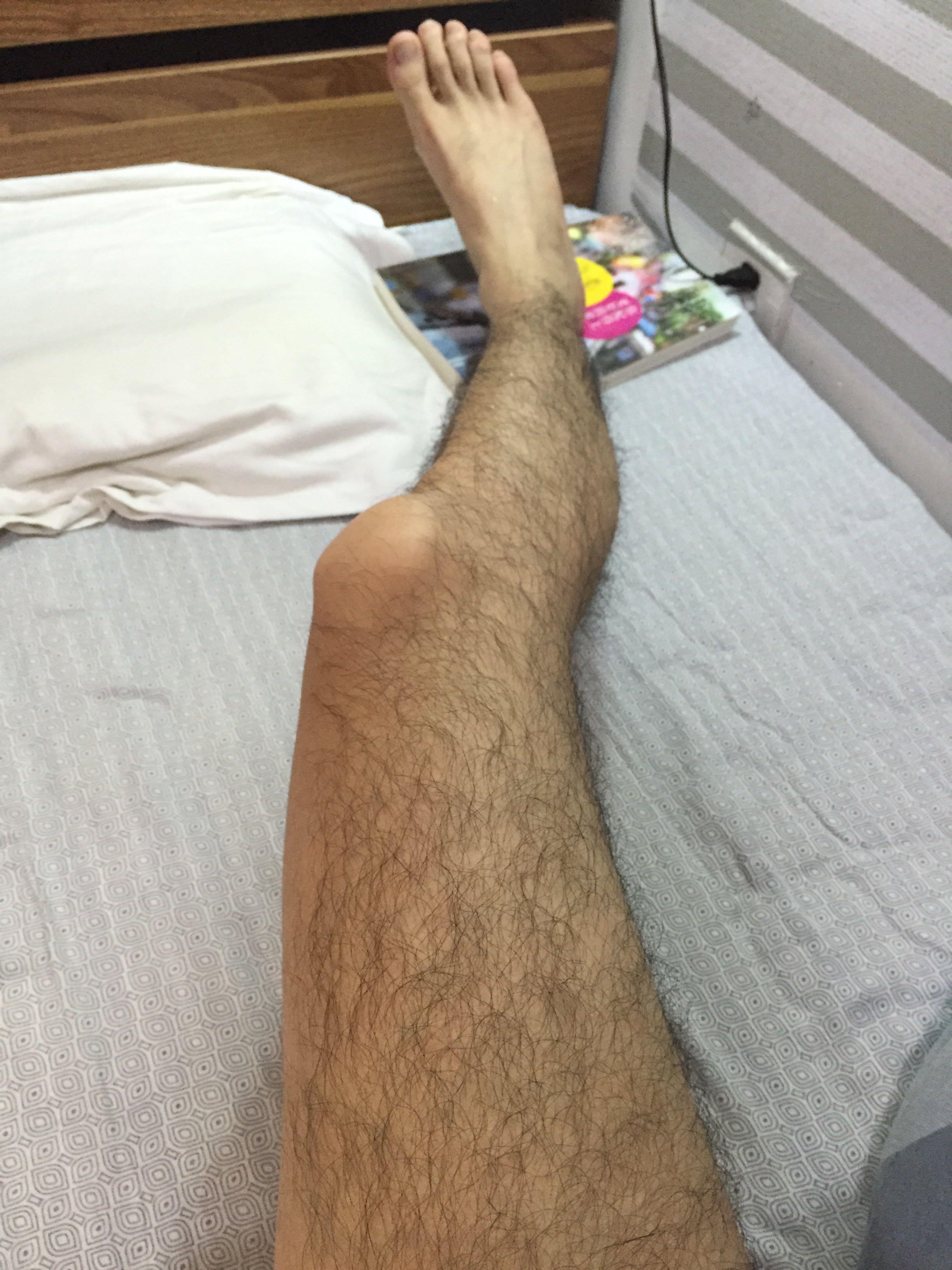 <em>体毛旺盛</em>是怎样一种体验? - 匿名用户的回答 - 