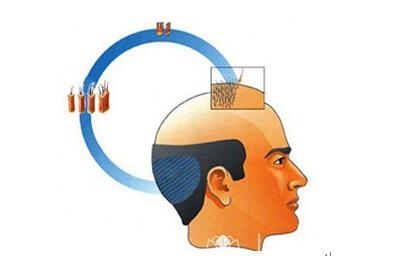 <em>头发</em>掉了<em>还会</em>在原来<em>掉头发</em>的地方重新<em>长</em>出来么