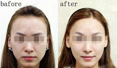 秃额角、发际线 高,适合<em>什么发型</em>? - <em>头发</em> - 知乎