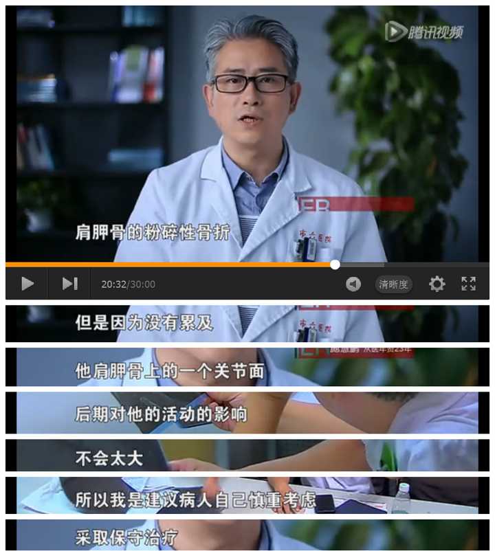 《急诊室故事》第二季 20151105 肩胛骨粉碎性骨折应该如何处理?