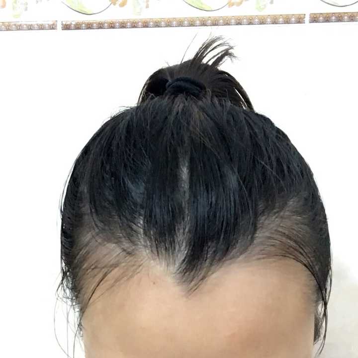 美人尖女生 知乎
