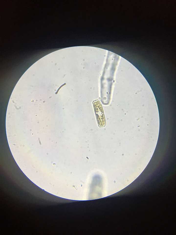 图中这个有点像瓶子的微生物具体是什么属(推测是种硅藻)?