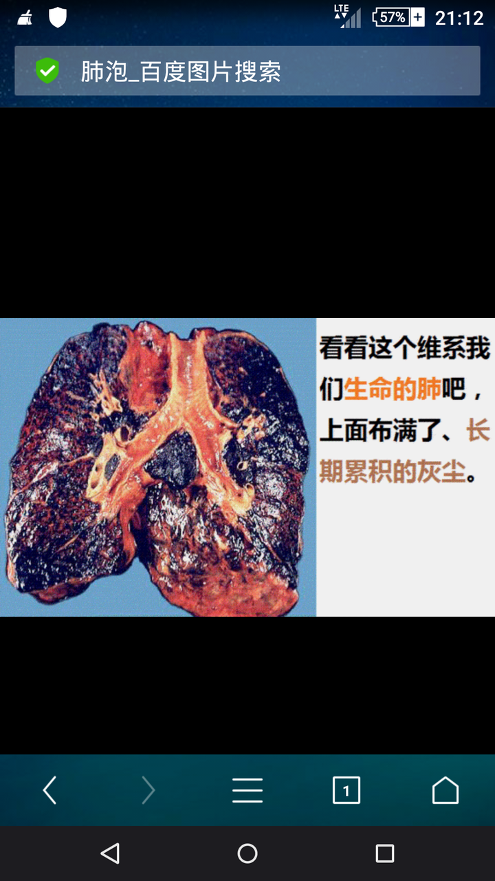 附着在肺泡上,所以年纪比较大的人他们的肺部看上去都比较脏,可以看看