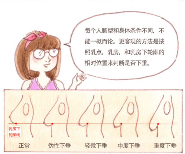 19岁女生有些胸下垂怎么才可以恢复?