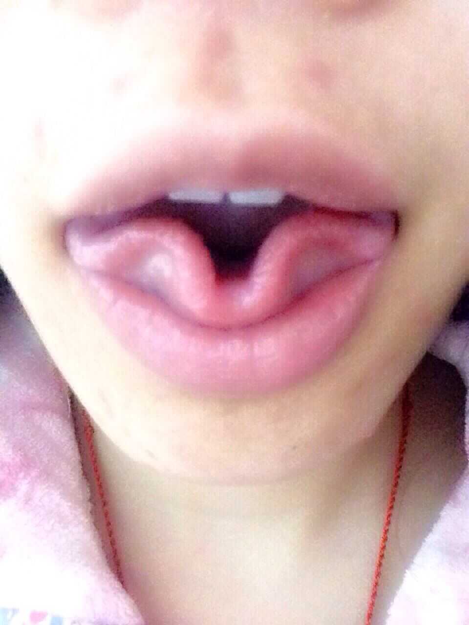 卷舌头卷成花瓣形…… 图片可能会引起某些人的不适慎拉……    显示