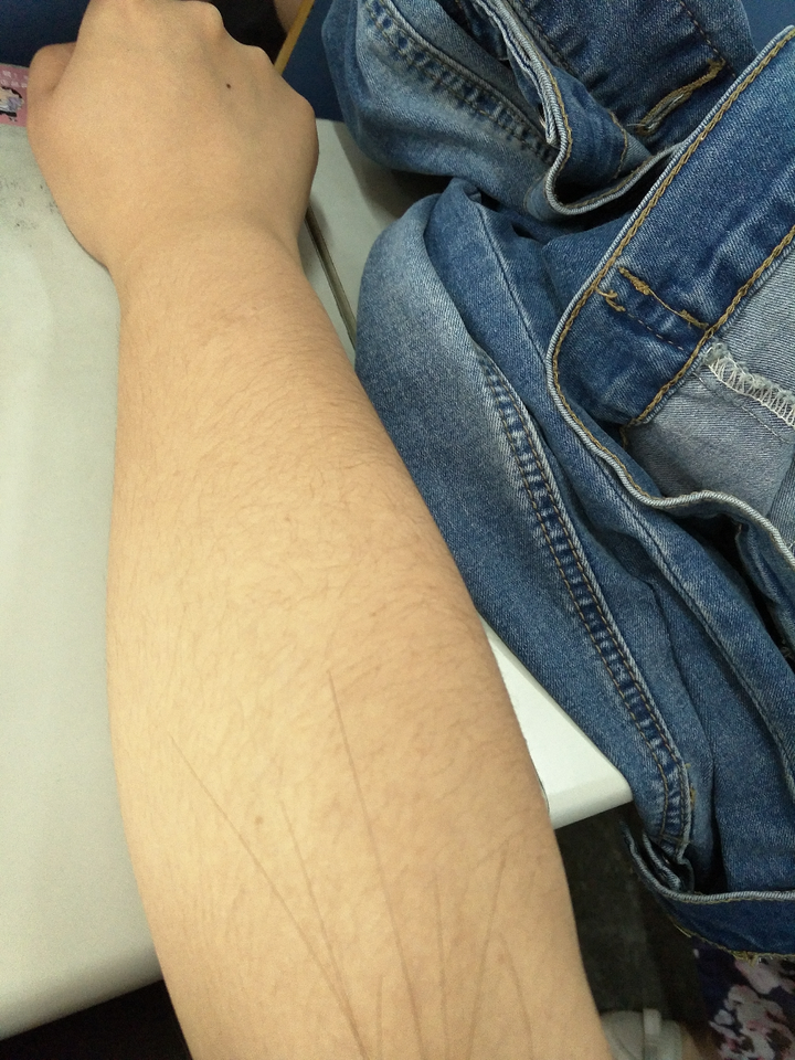 其余流程进行速 第一次更新:从青春期以后,腿毛上汗毛又粗又浓,腋窝