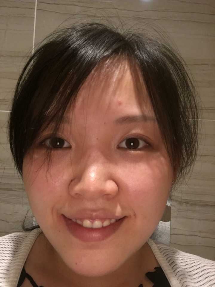 鼻子塌的女孩怎样由丑变美?