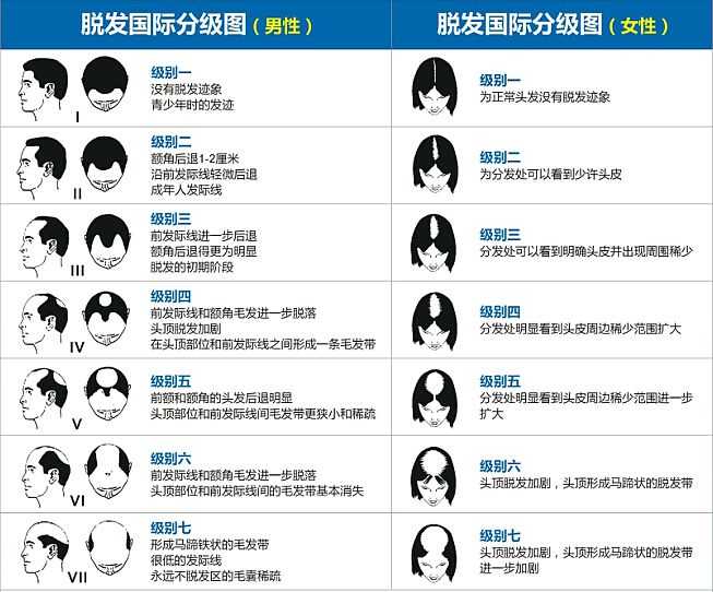 由于图片看不太清你究竟脱了多少发,所以我这里发一张脱发等级图,你