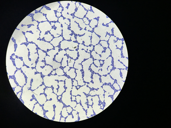 革兰氏染色(gram stain )经典,常用.