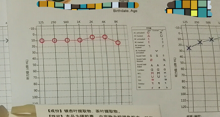 5.28号又来了一次,又去做了个电测听,还是正常 正常的是这样的