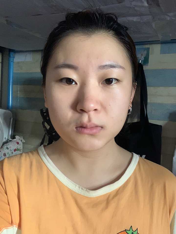脸型极度不对称是什么体验?