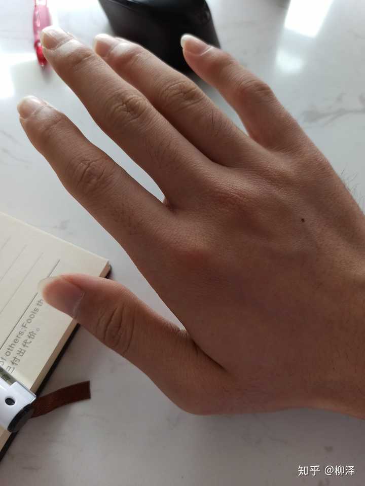 练吉他真的能瘦手指吗?