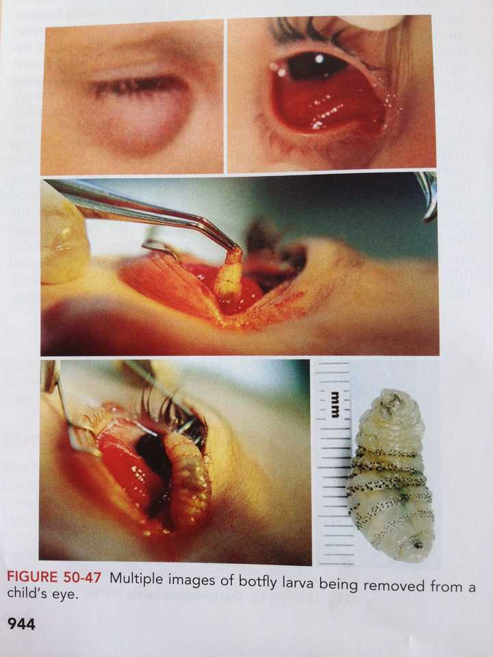 ====== ===== ===== ===== 这是非常典型蝇蛆病, 皮蝇(botfly)通过