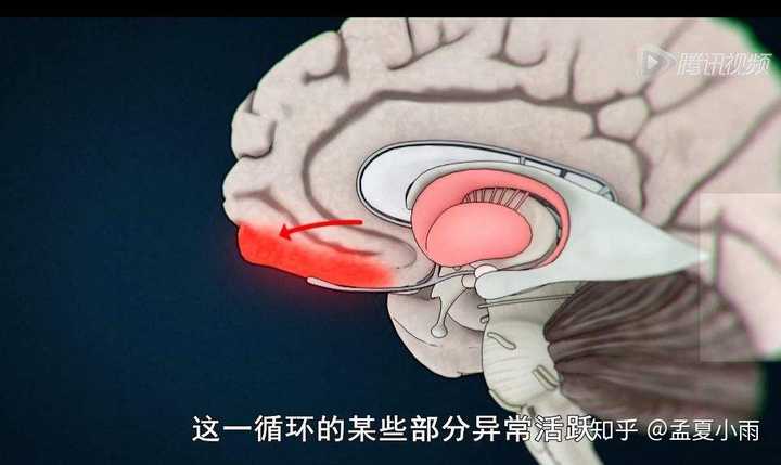 强迫症的原理是什么?