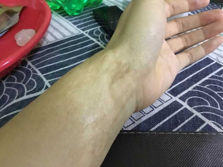 男性是如何看待女性的疤痕的?