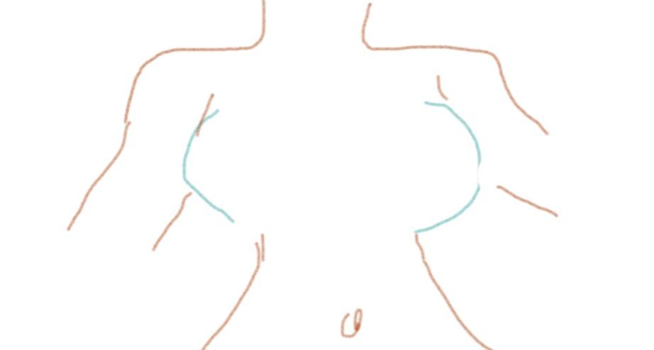 乳房间距大胸部外扩严重,如何锻炼才能塑造好看的胸型,做到让乳房里侧