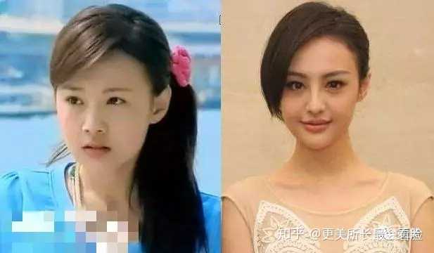 杨幂为什么爱挖鼻孔?