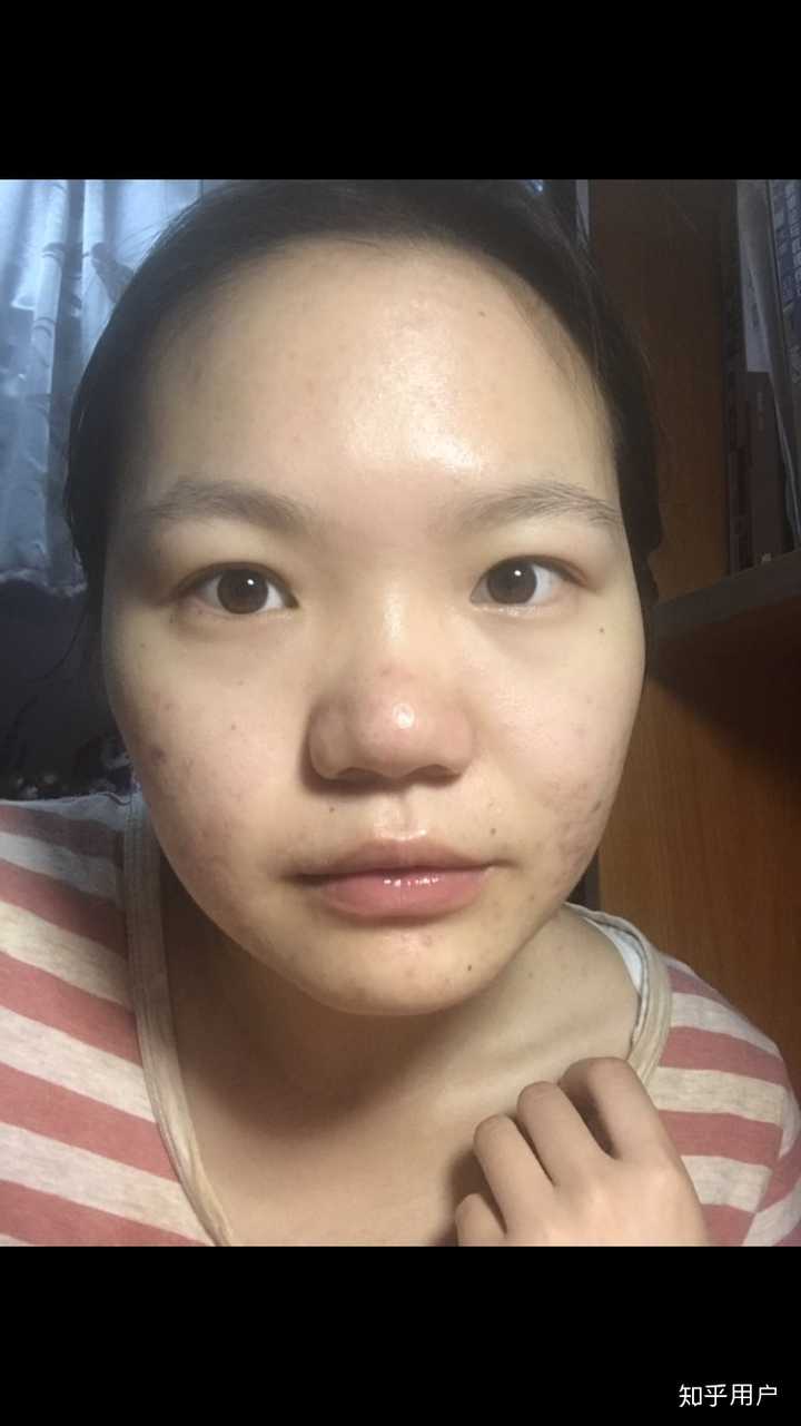 塌鼻子的女生留什么发型好看?