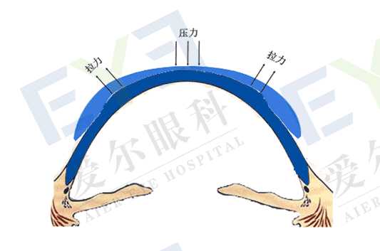 谢邀.我来回答: q: 什么是角膜塑形镜?