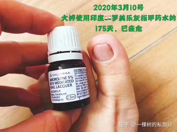 找到适合自己的一款治疗灰指甲的特效 ——盐酸阿莫洛芬擦剂(罗美乐)