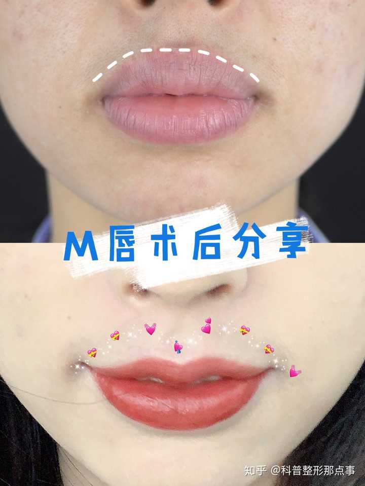 所以说一个唇形好不好看还是很重要的啦!