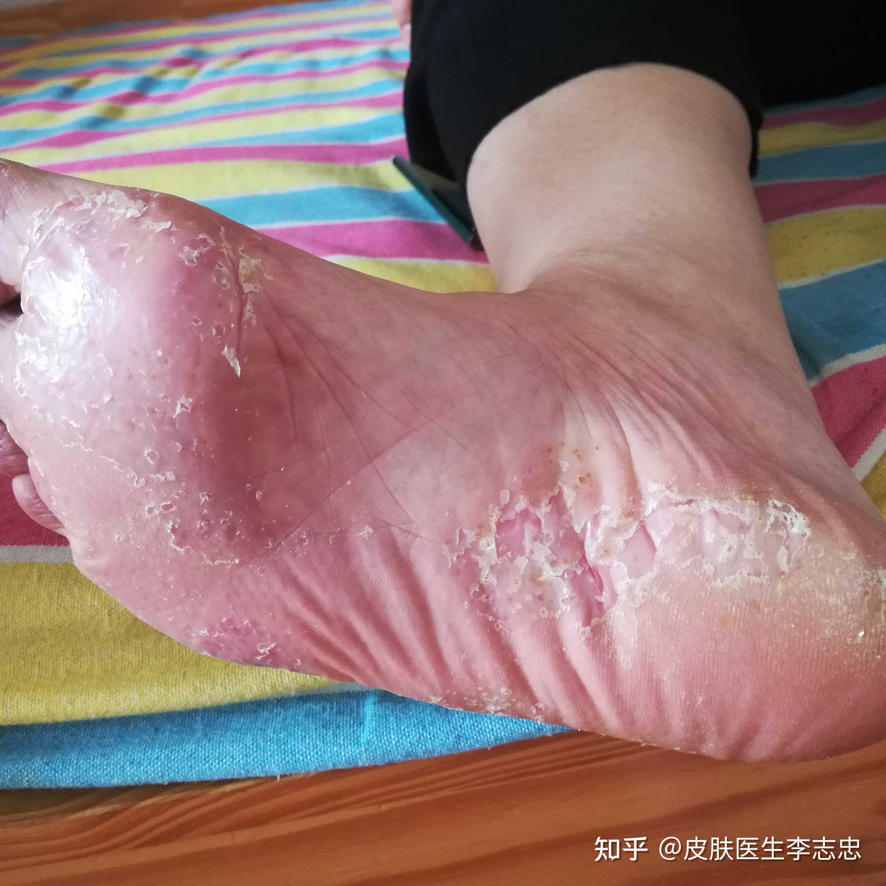 皮肤医生李志忠