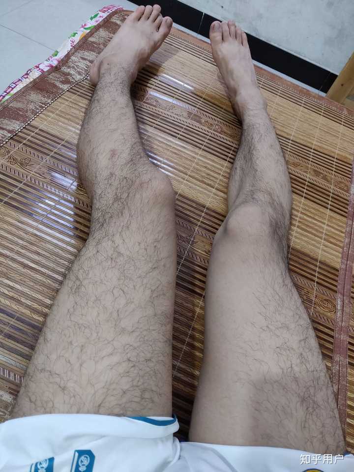 男生腿毛浓密怎么办?