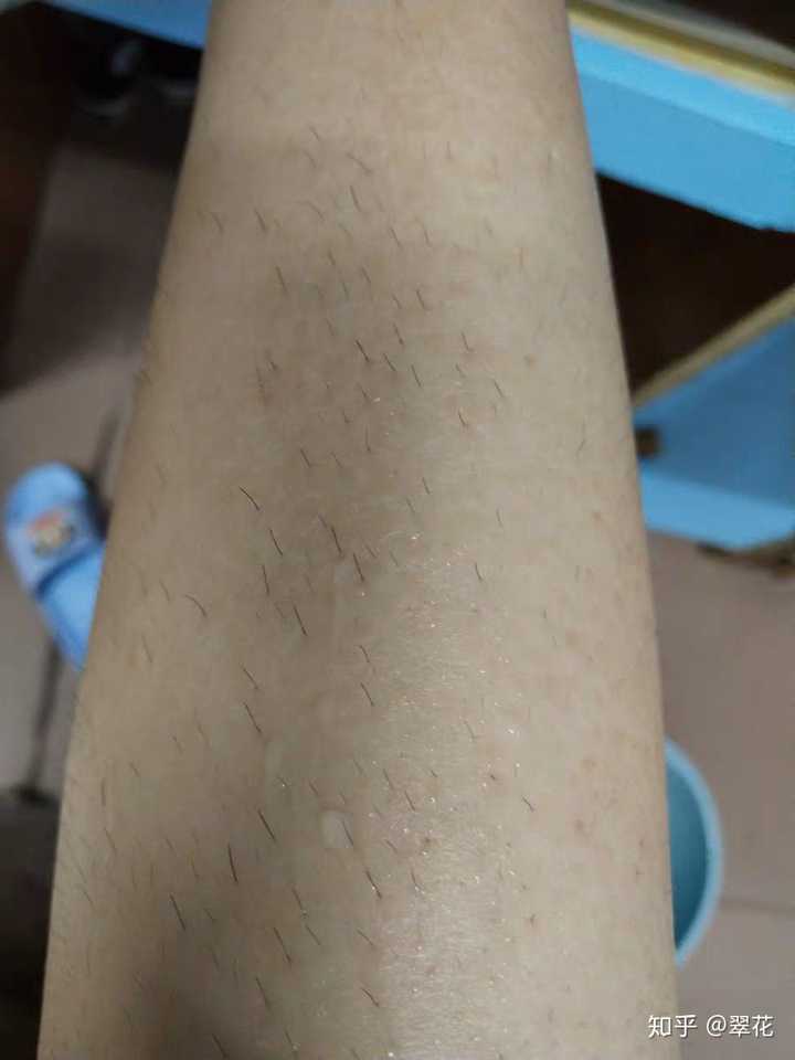 这是用了脱毛膏后新长出来的