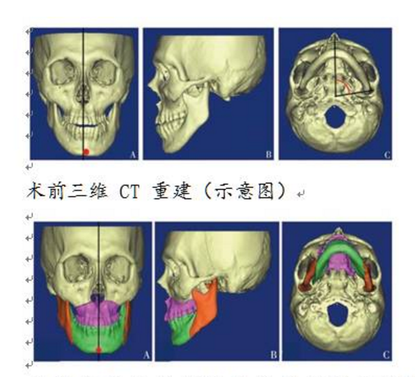 包括纠正唇腭裂,面部先天及后天畸形,面部创伤修复和面部轮廓整形等.