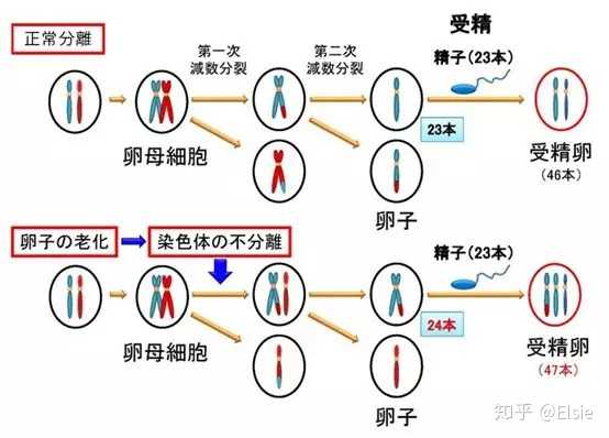 将会导致三体胚胎的形成,最常见的便是21三体综合征(唐氏综合征)