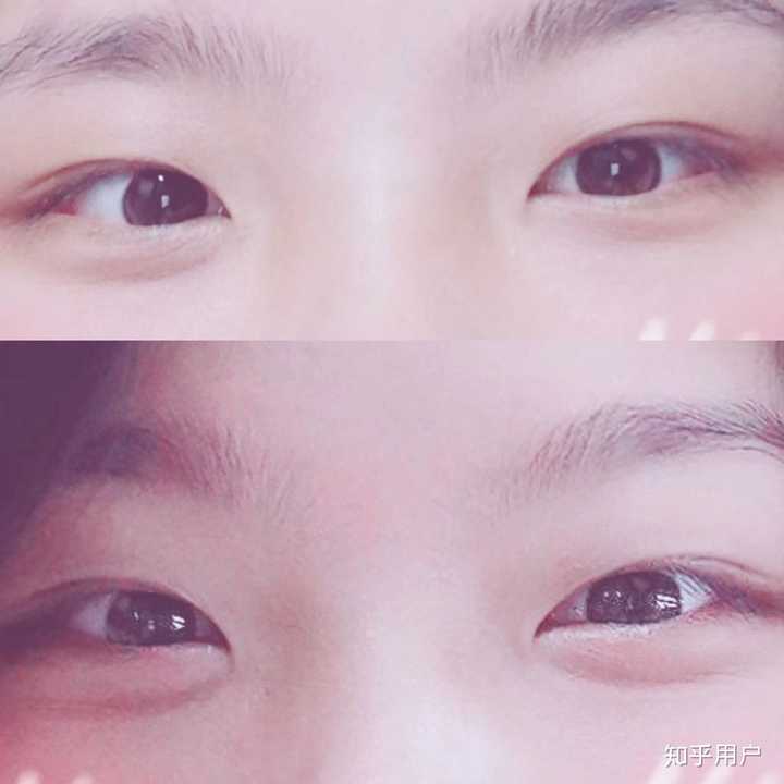 抑郁症痊愈后性格会发生什么变化?