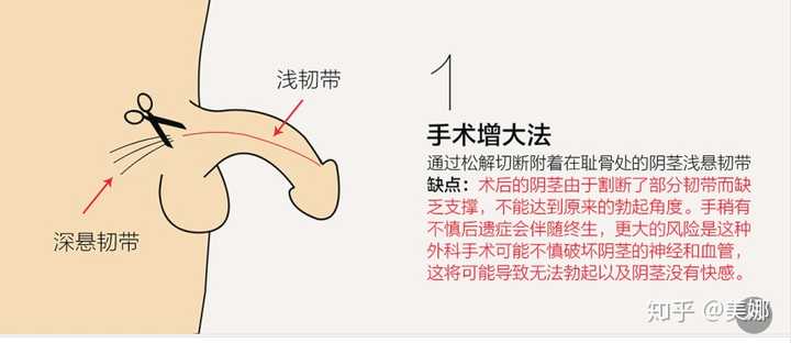 现在市场上的那些男性延时增大增粗产品真的有效吗