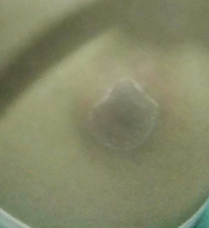 屁股上长个火疖子是什么感受 ?