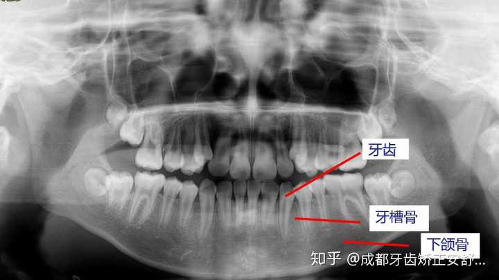 牙齿,牙槽骨,颌骨关系图