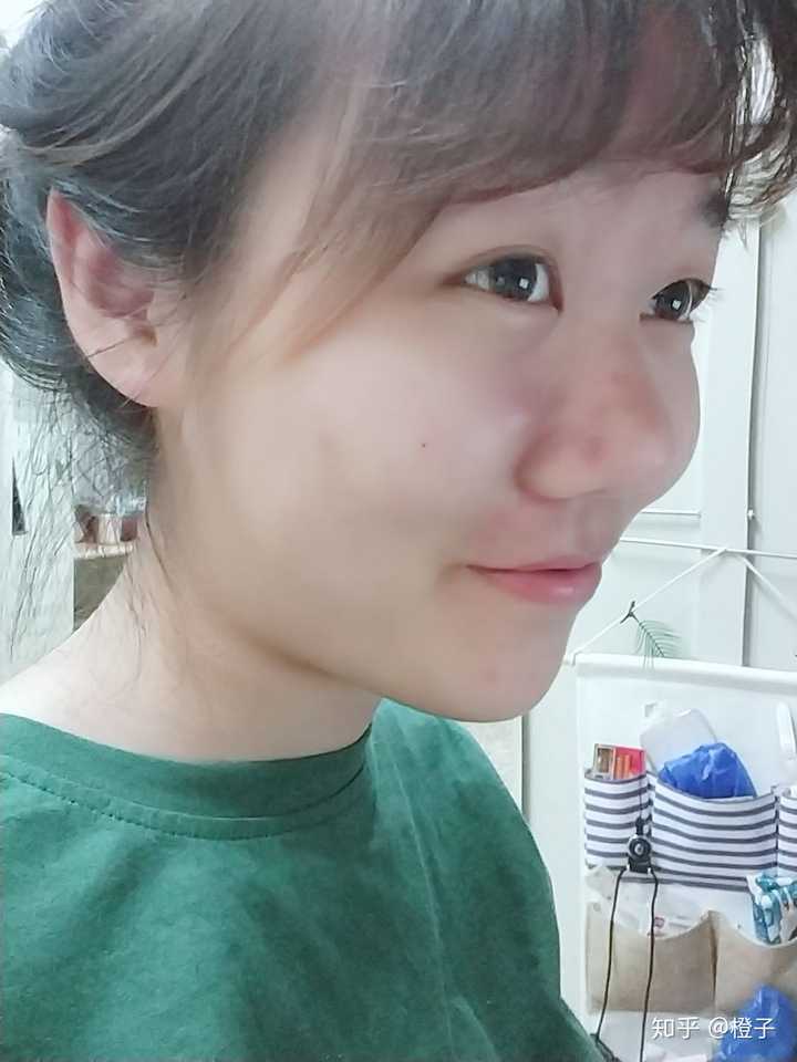 因为长相的原因(厚嘴唇,蒜头鼻)产生了深深的自卑感