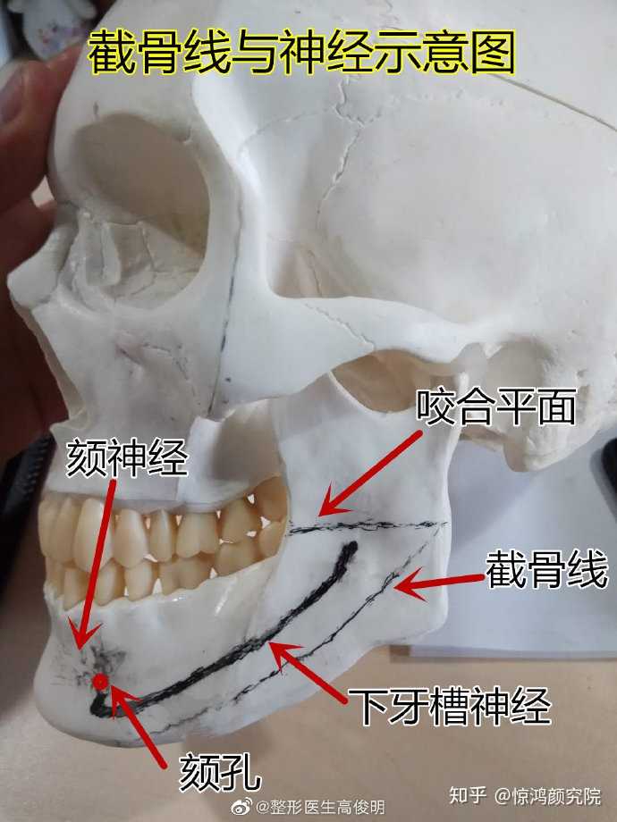 下牙槽神经是从下颌骨的内侧穿入下颌骨,然后从外侧的颏孔穿出,中间的