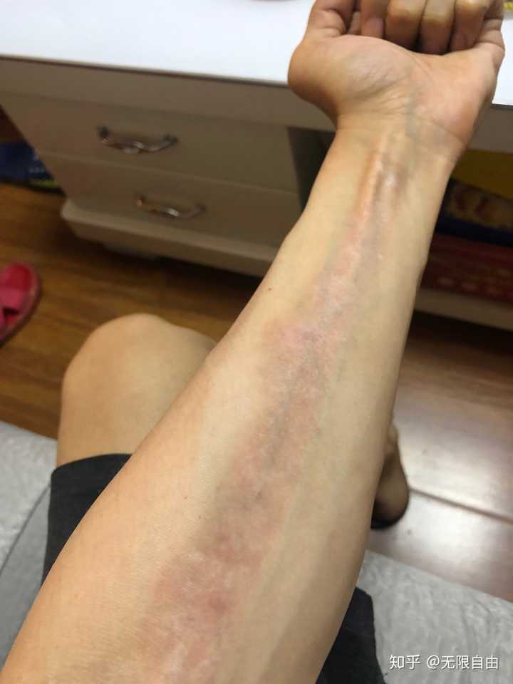 洗纹身应该注意什么,纹身店,美容院,医院找哪个洗纹身