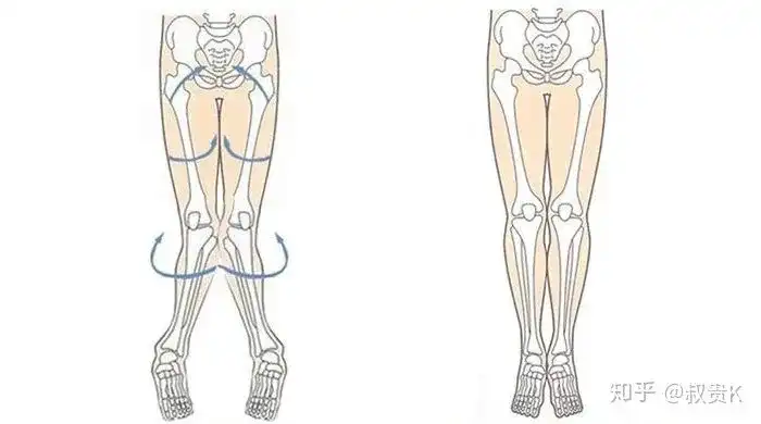 无法并拢大腿膝盖和小腿那就是骨盆后倾,股骨及膝外旋导致的o型腿