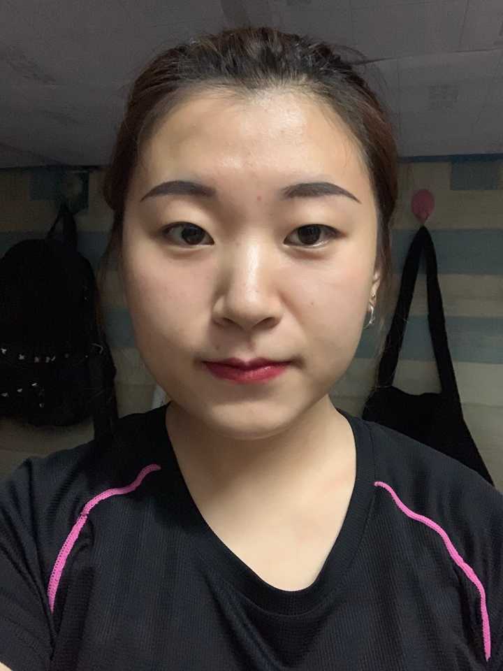脸型极度不对称是什么体验?