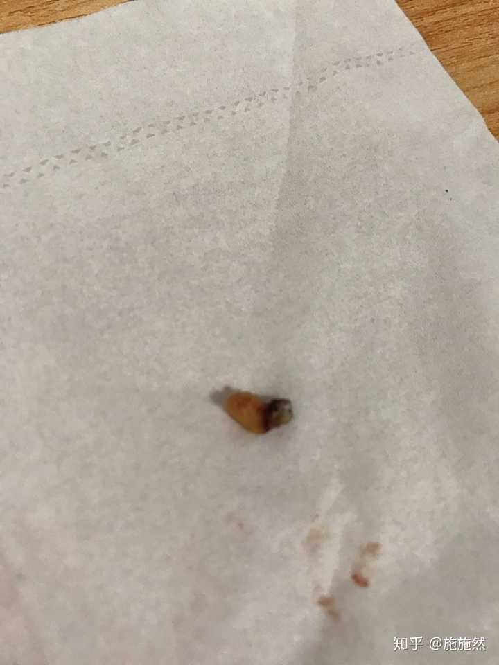 史上最大的黑头有多大?