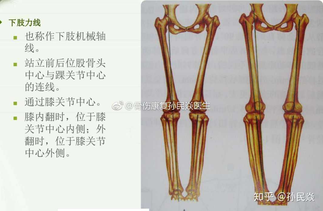 为什么要花比较大的精力去研究下肢力线,各种角度等?