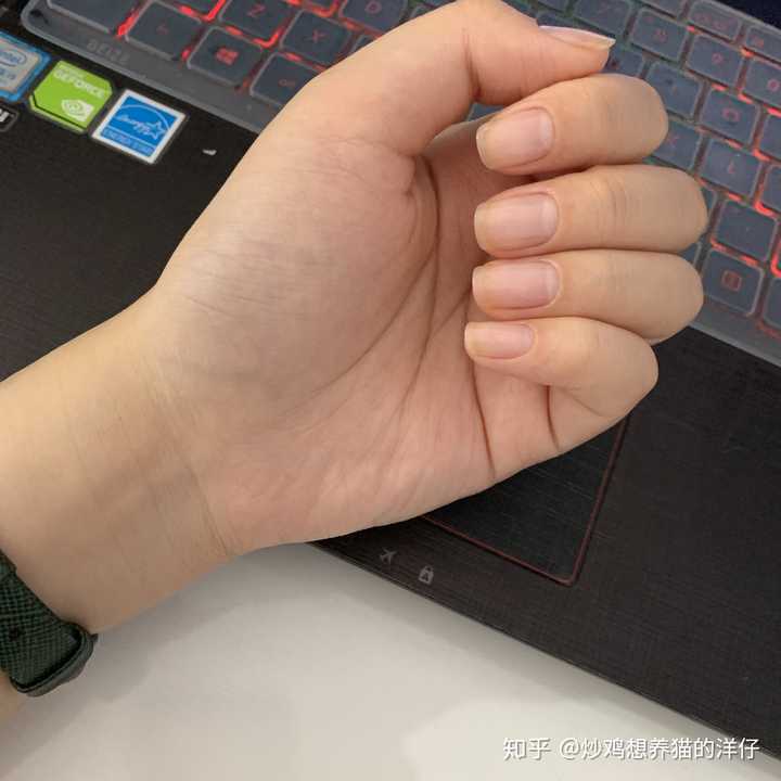 甲床过短应该如何变长?