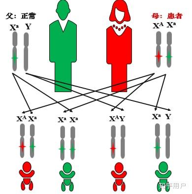 一,x连锁显性遗传(xd)