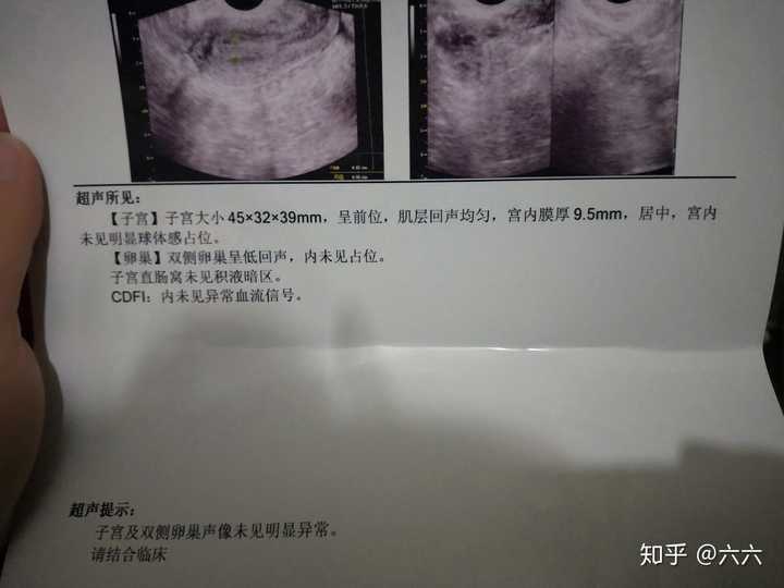 各位医生朋友帮我看看  今天检查了阴超然后这种算有多囊卵巢综合症吗