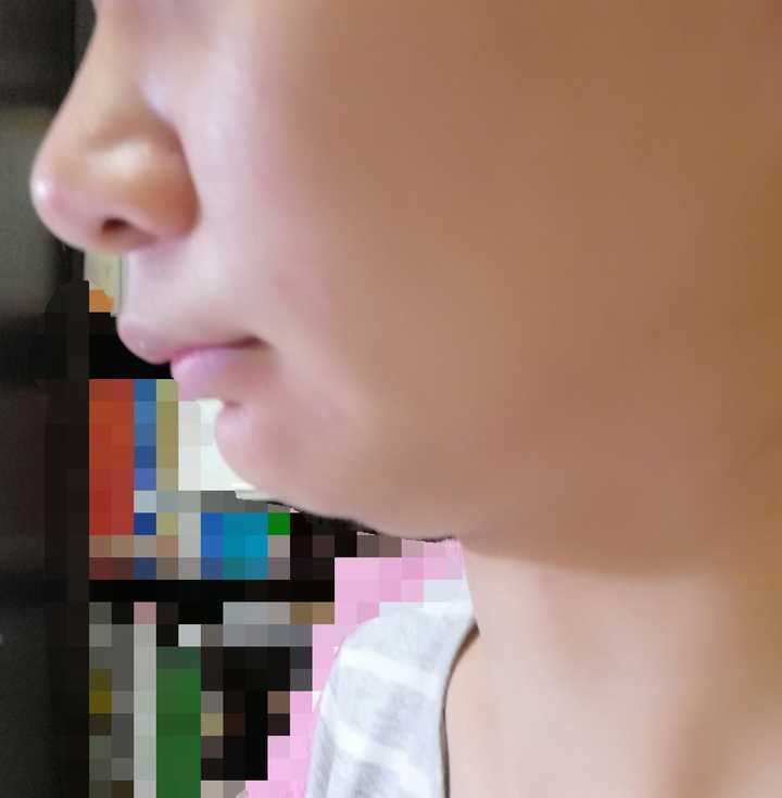 脸方,没下巴,没鼻梁,侧脸难看是一种什么体验?