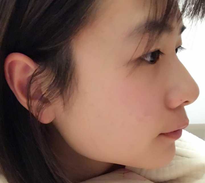 脸正面好看侧面不好看是一种怎样的体验?