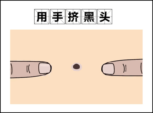 如何去黑头缩毛孔,鼻子周围红血丝,嘴角下巴暗沉?